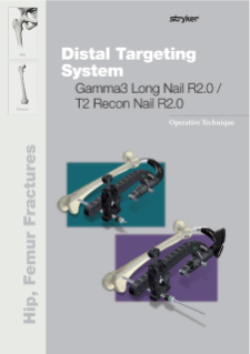 Distal Targeting System R2.0 Gamma3 Long Nail/T2 Recon Nail Operative Technique