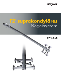 T2® suprakondyläres Nagelsystem OP-Technik