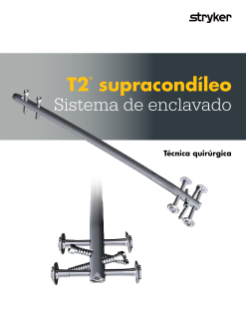 T2® supracondíleo Sistema de enclavado Técnica quirúrgica