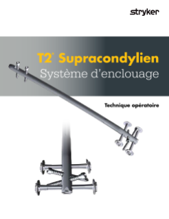 T2® Supracondylien Système d’enclouage Technique opératoire