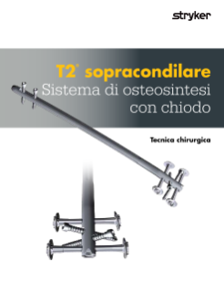T2® sopracondilare Sistema di osteosintesi con chiodo Tecnica chirurgica