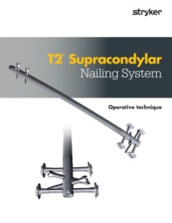 T2 Supracondylar operative technique