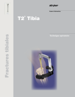 T2 Tibia | Stryker