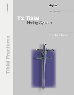 T2 Tibial Nailing System operative technique.pdf