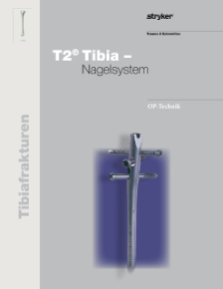 T2® Tibia Nagelsystem
