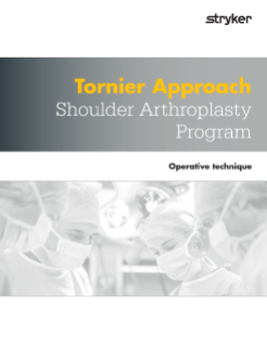 Tornier Approach operative technique.pdf