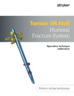 Tornier IM Nail Operative Technique Addendum