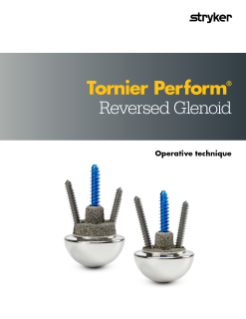 41 Tornier_Perform_Reversed_Glenoid_AP-012146C_EN.pdf