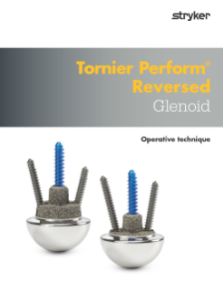 AP-010185E Tornier Perform Reversed Glenoid Op Tech.pdf