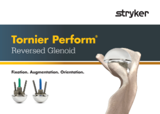 Tornier Perform Reversed Glenoid Brochure.pdf