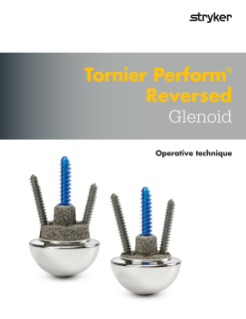 Tornier Perform Reversed Glenoid operative technique.pdf