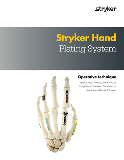 Stryker Hand Plating System operative technique